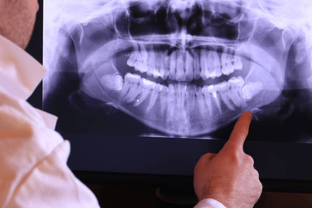 Best Emergency Dental Care for Broken or Chipped Teeth in Parkland, FL